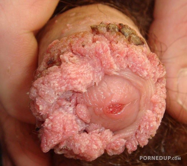 nude shemale penis vagina