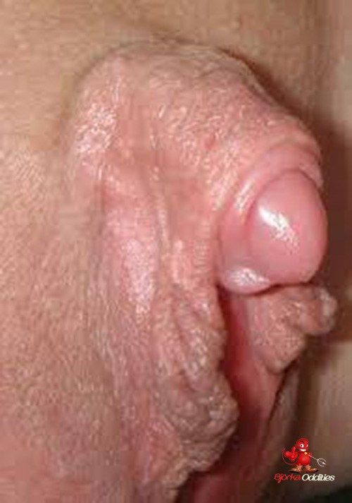 mature labia clitoris