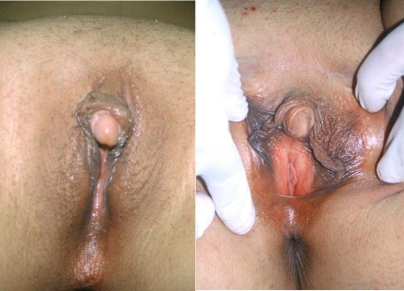 woman clitoris penis