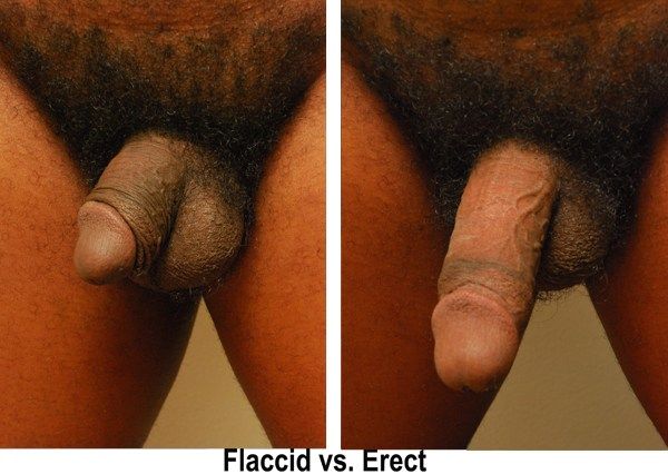 erect penis front