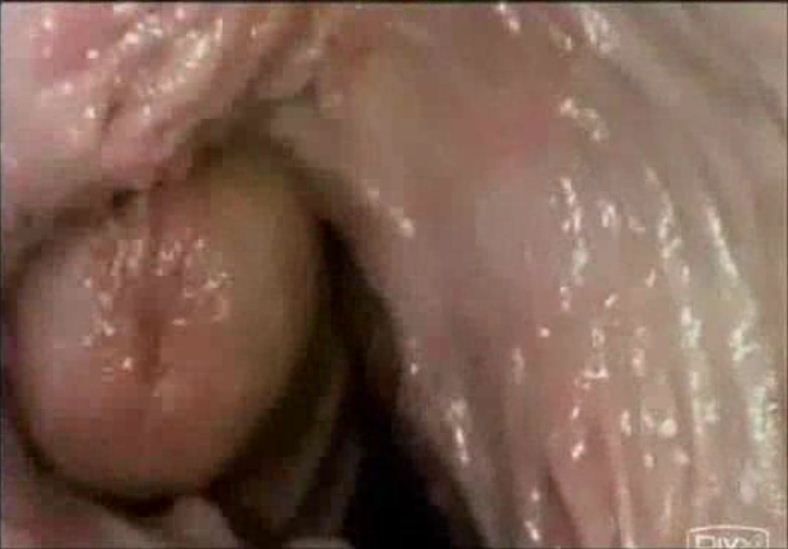 Camera Inside Vagina During Sex Gif