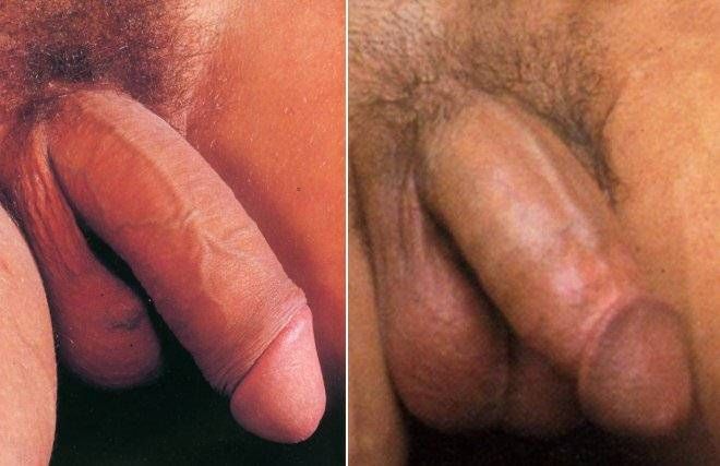 mature nude erect penis