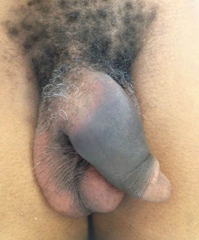 male with vagina sex