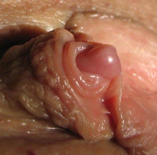 erect average clitoris