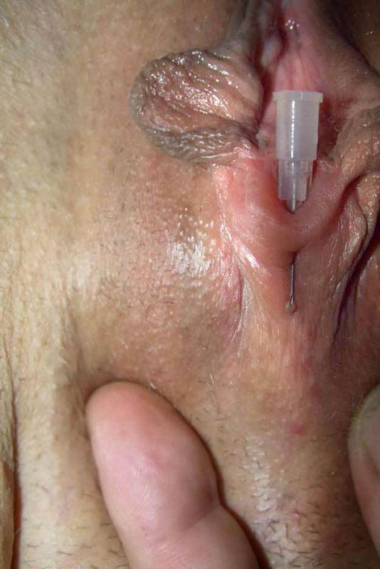 penis insertion anal sex