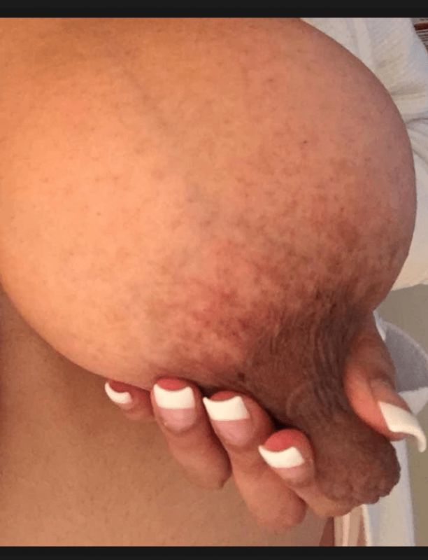 tits huge
