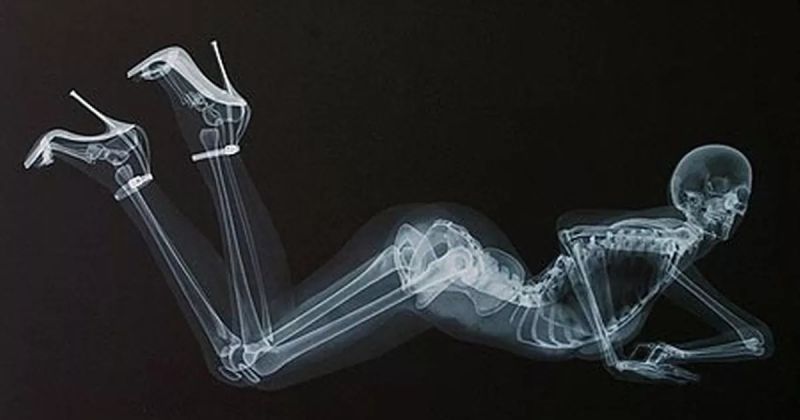 cat x ray