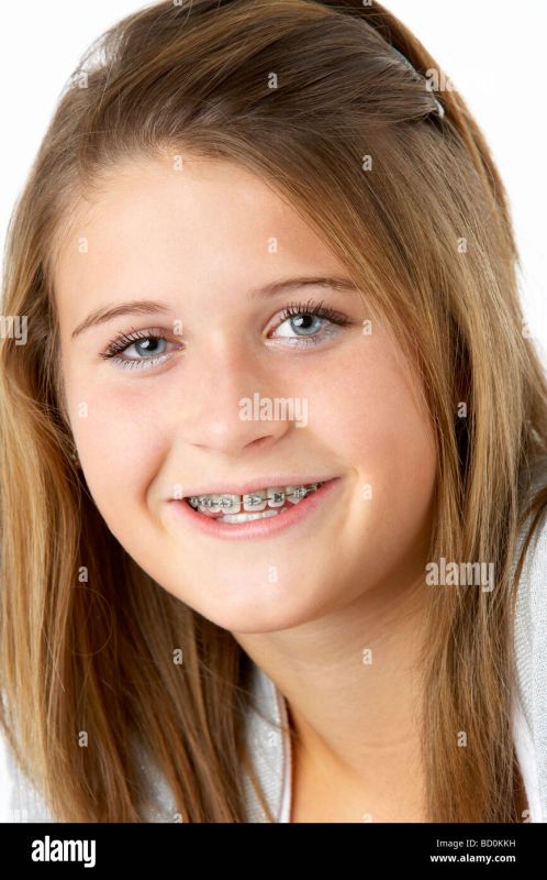invisalign