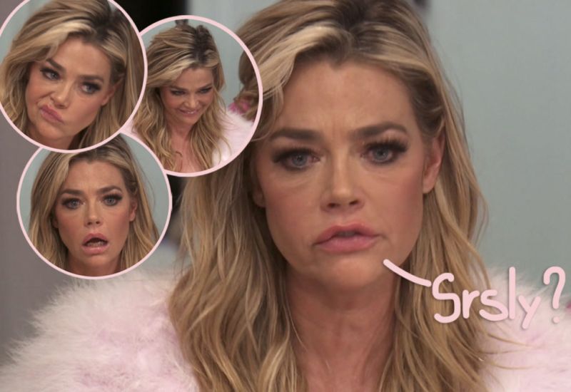 denise richards four hernias