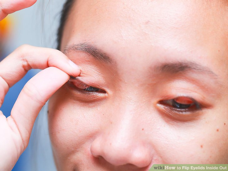 skin discoloration