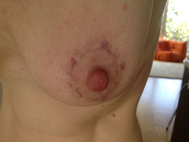 full nude