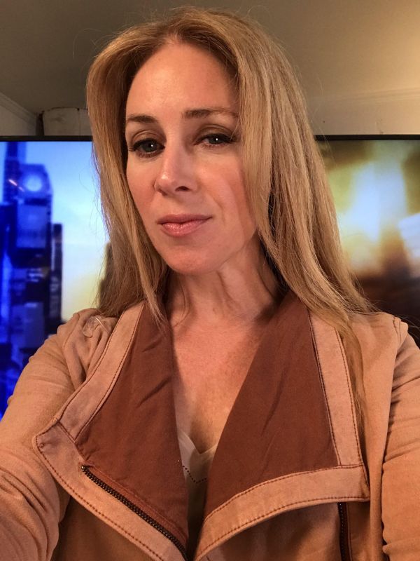 becky botox