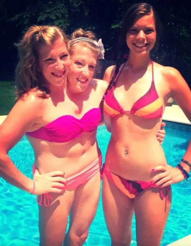abby and brittany hensel back