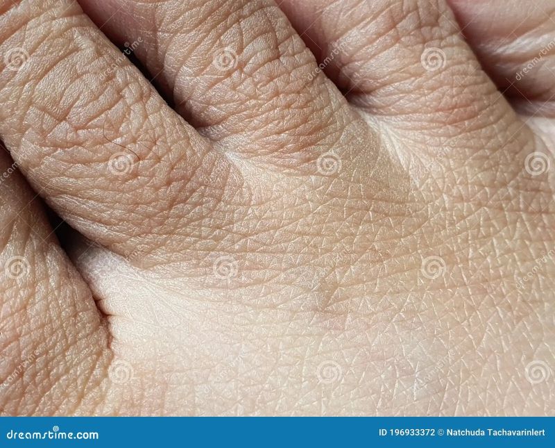 wrinkles on heel