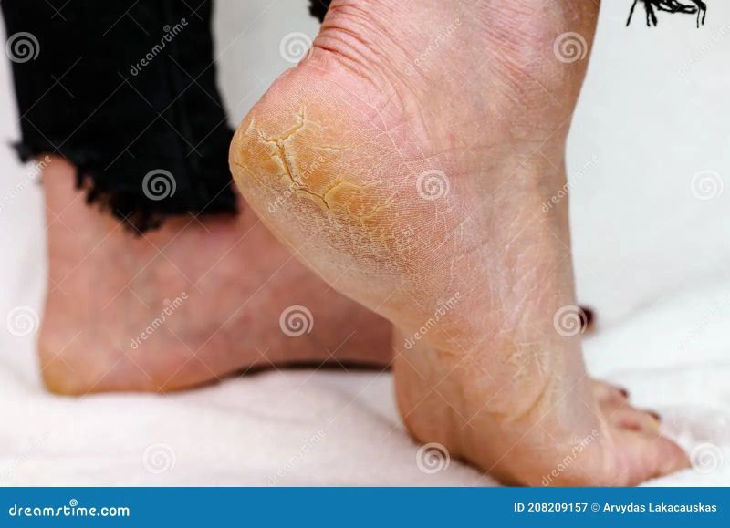 dermaneedling wrinkly skin