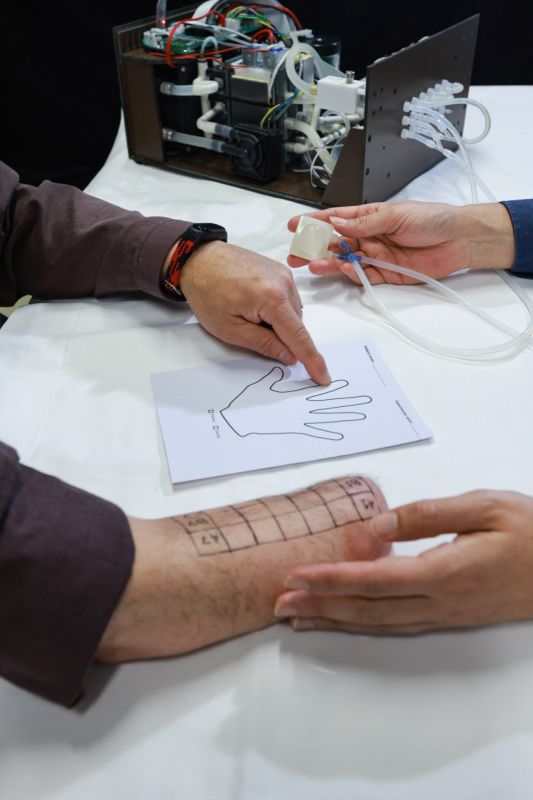 wrist amputation