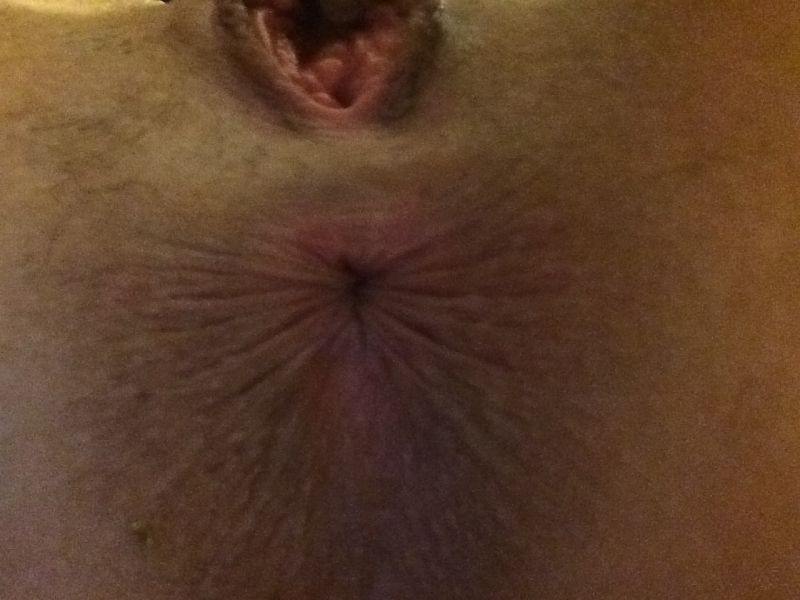 hope solo hole