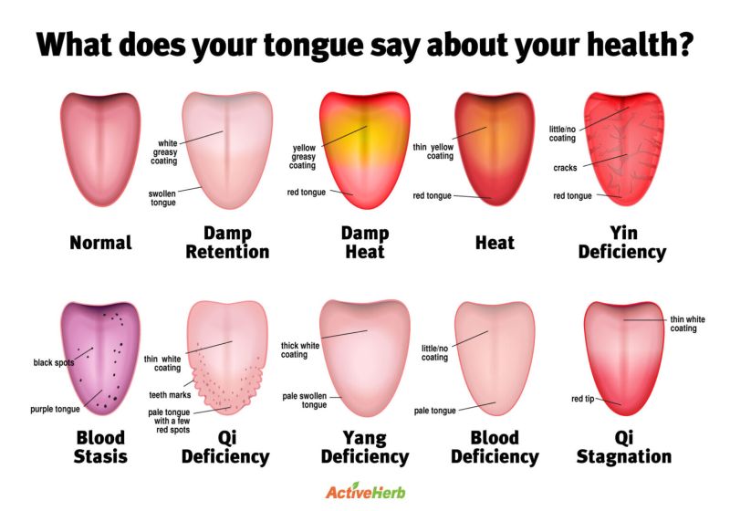 body parts