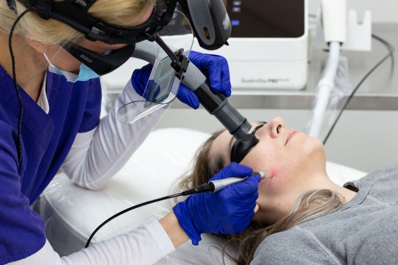 most effective laser skin resurfacing