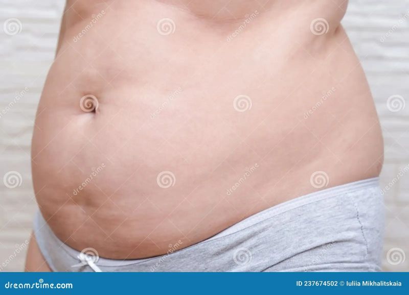 pcos belly fat