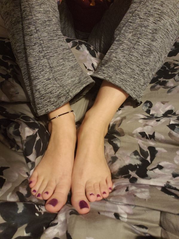 discoloration nail