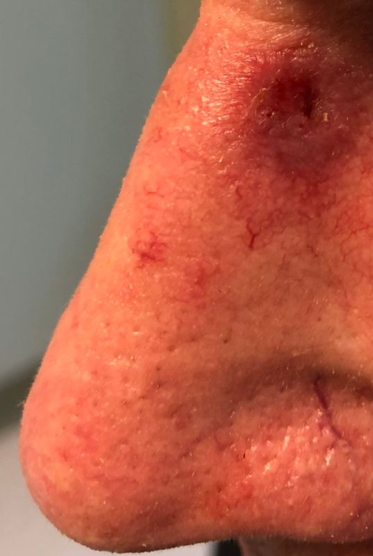 inside your nose