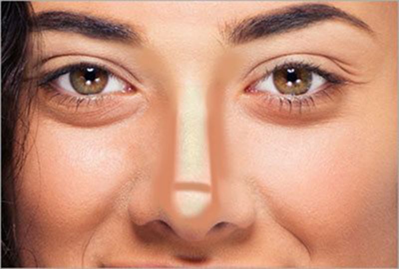 swollen eyelid