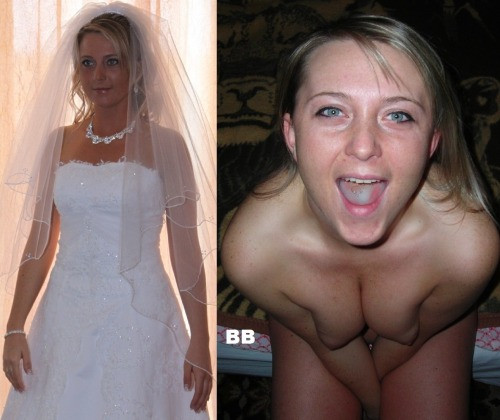 profhilo before after
