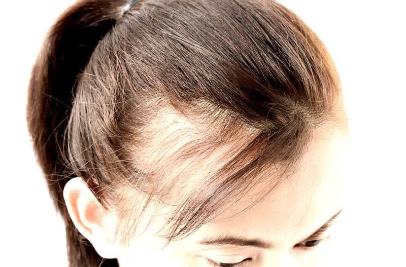 best hair growth vitamins for women
