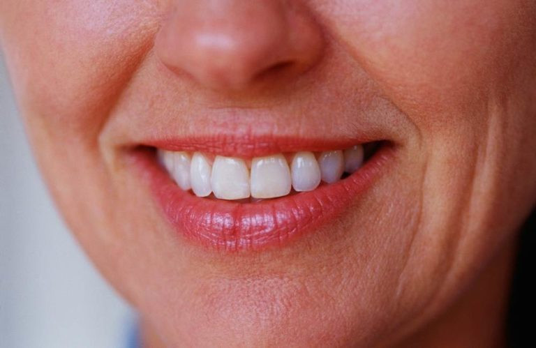 lip wrinkles