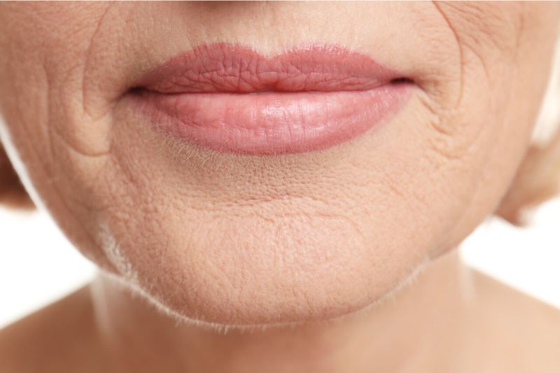 wrinkly lips