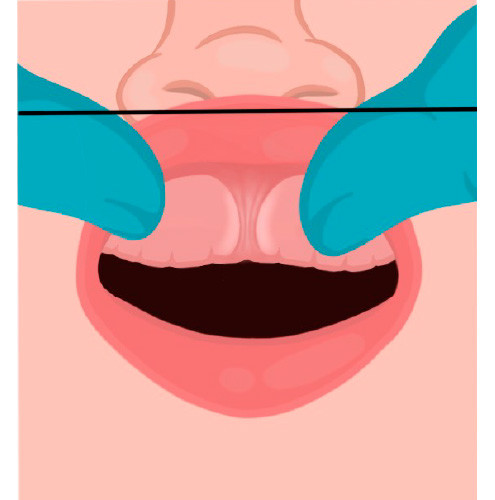 frenulum of tongue