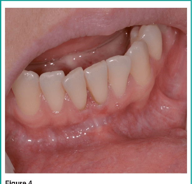 bottom of tongue anatomy