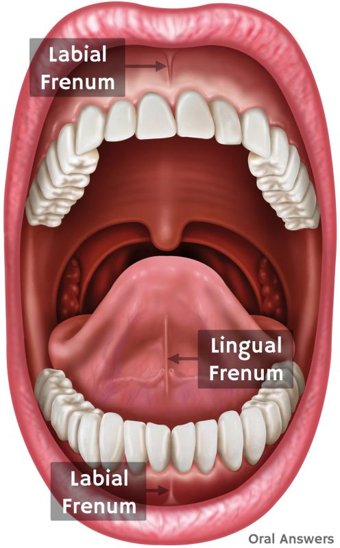 top lip connect to gum