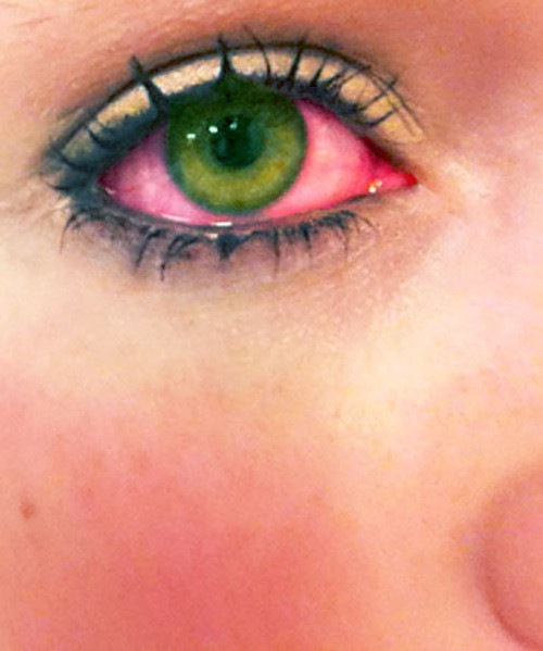 stoned eyes