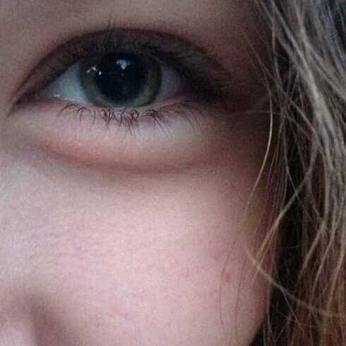 pics of high eyes