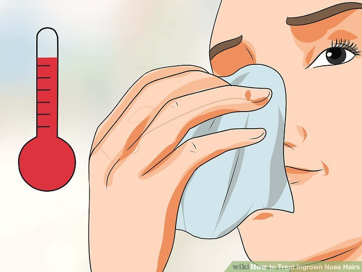 fix ingrown hair on inside nose
