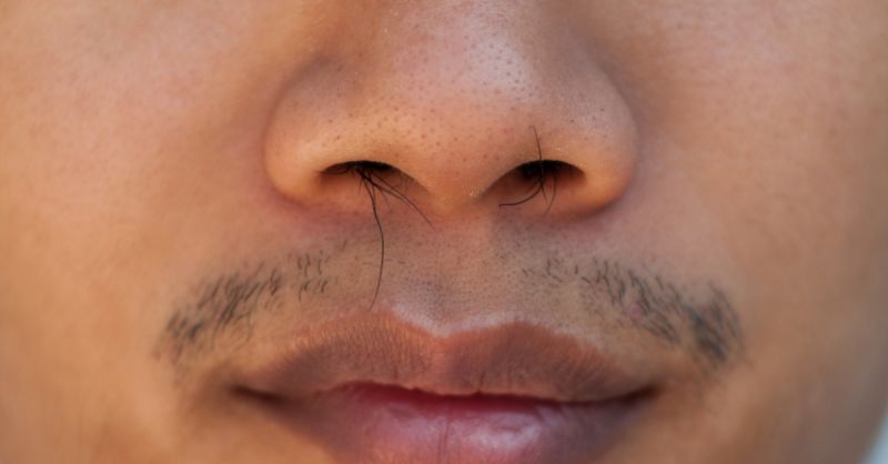 razor bumps ingrown hair