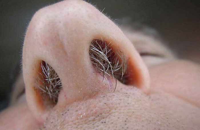 ingrown hair on back of neck