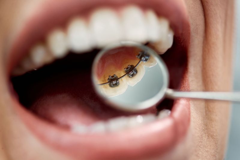 clip art