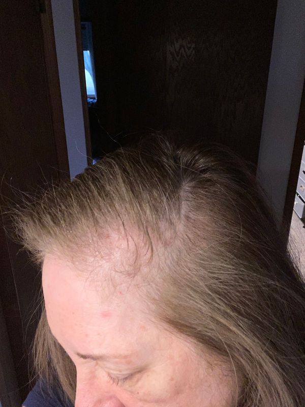 kb shampoo