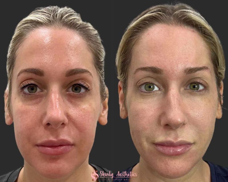 amazing photoshop
