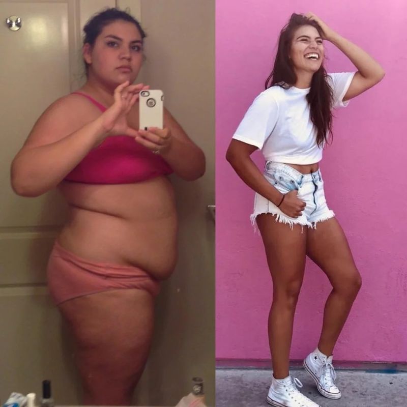 extreme weight loss before and after