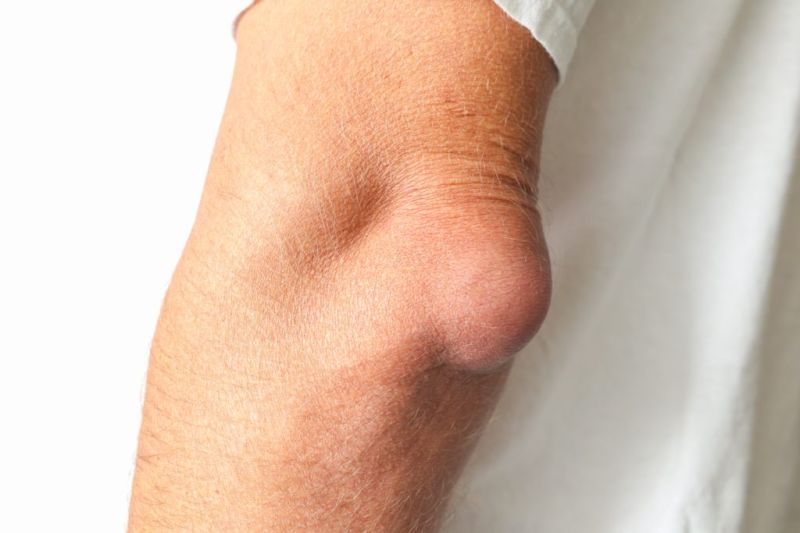 joint pain