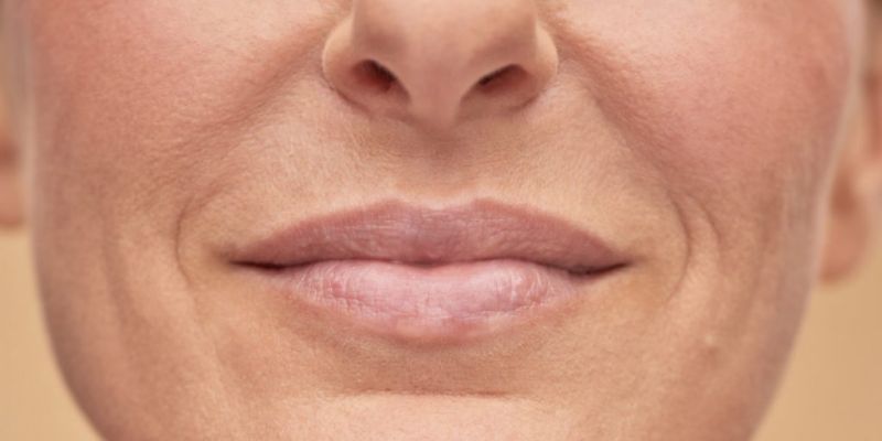 filler around the mouth